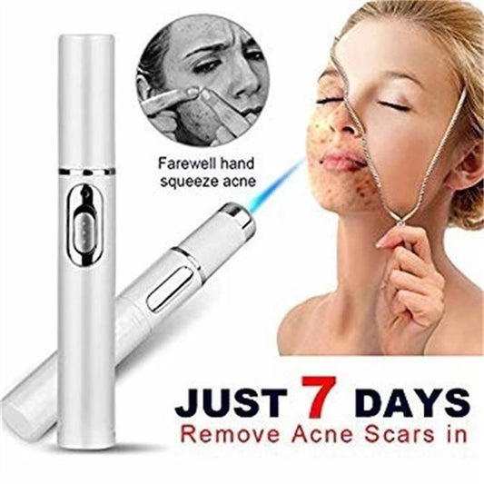 Blue light therapy acne laser pen promoting removal of acne scars in just 7 days, skincare beauty device.