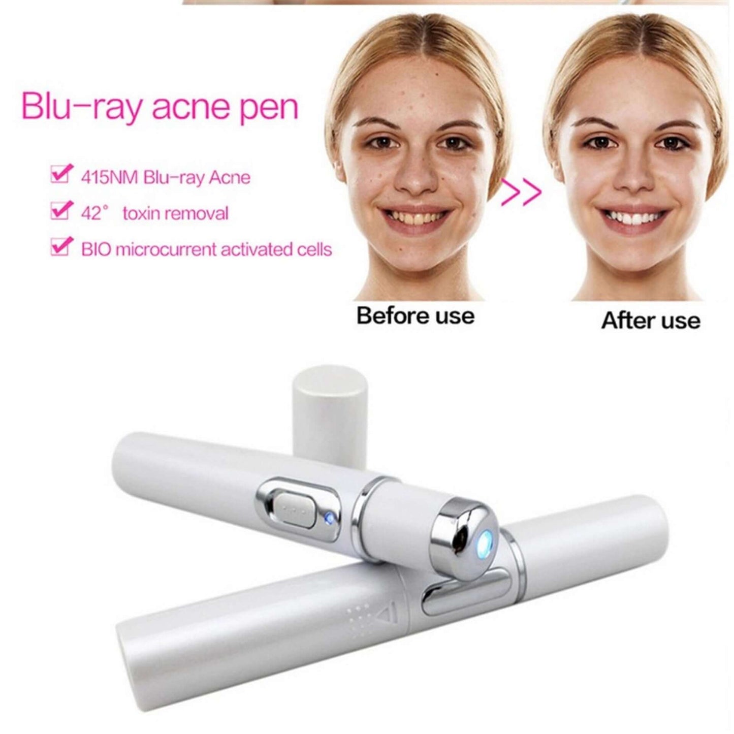 Blue light therapy acne laserpen from bloomritual store