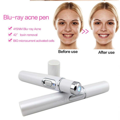Blue light therapy acne laserpen from bloomritual store