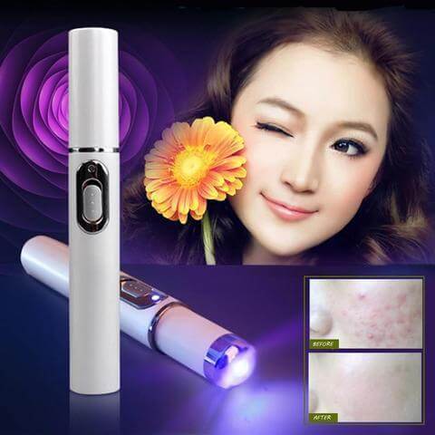 Blue light therapy acne laser pen for skin treatment with before and after results, showcasing skincare benefits.