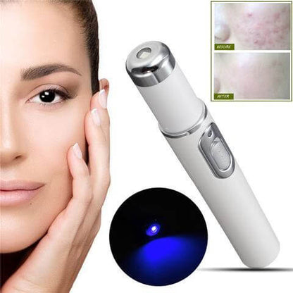 Blue light therapy acne laserpen from bloomritual store